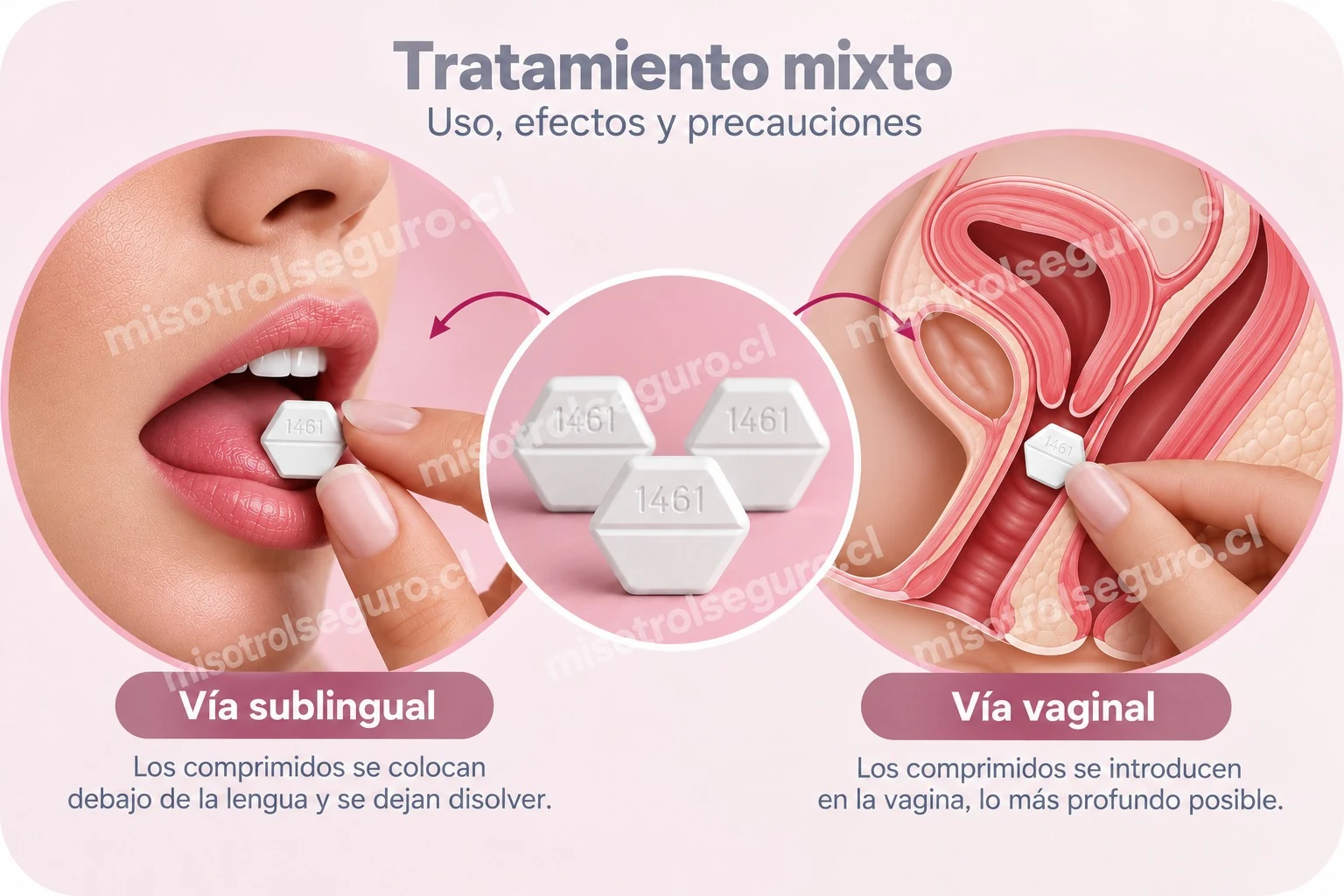 Tratamiento mixto: uso, efectos y precauciones de las vías sublingual y vaginal